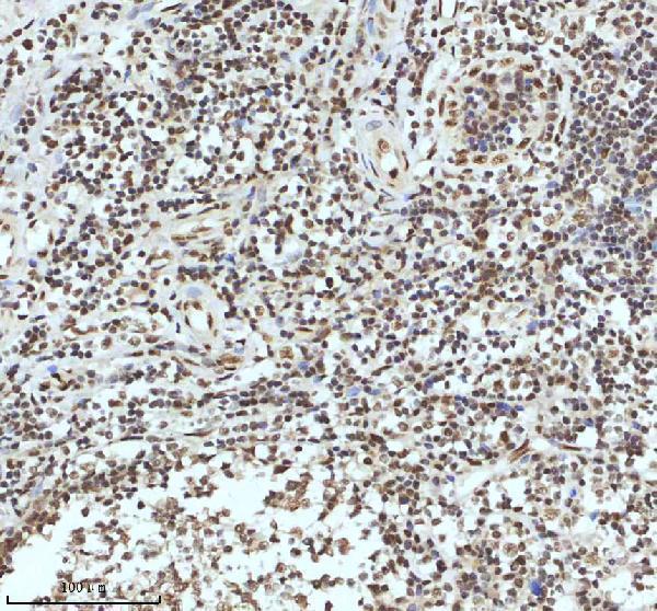 a11406 2 irf2bp1 primary antibodies ihc testing 17