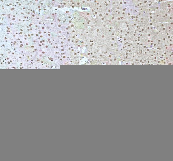 a11406 2 irf2bp1 primary antibodies ihc testing 18