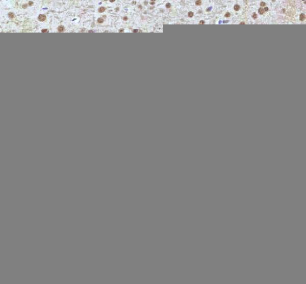 a11406 2 irf2bp1 primary antibodies ihc testing 19
