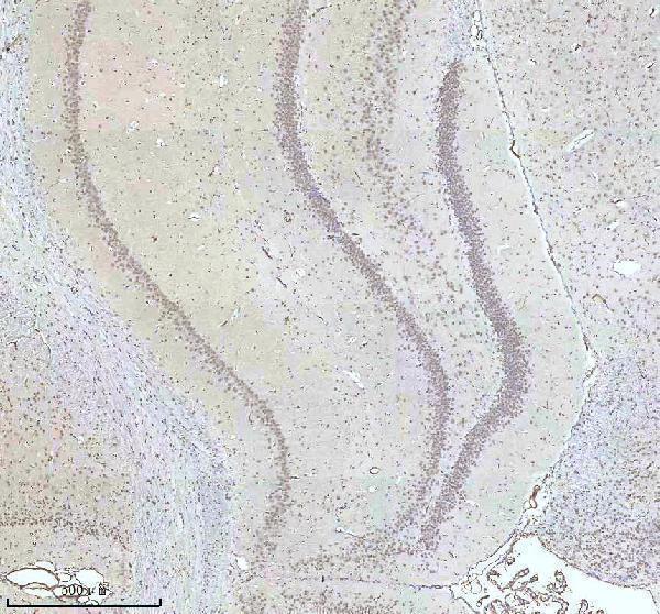 a11406 2 irf2bp1 primary antibodies ihc testing 20