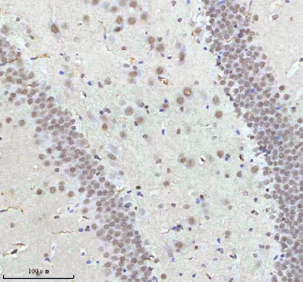 a11406 2 irf2bp1 primary antibodies ihc testing 21
