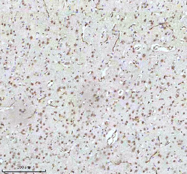 a11406 2 irf2bp1 primary antibodies ihc testing 22