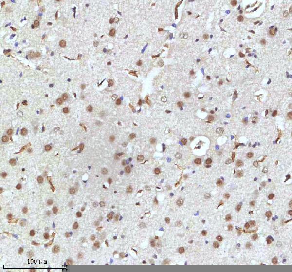 a11406 2 irf2bp1 primary antibodies ihc testing 23