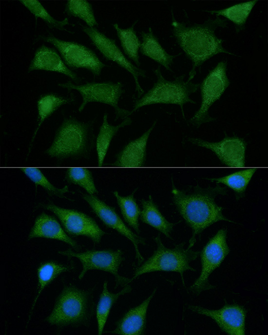 Immunofluorescence analysis of L929 using TRIM45 antibody  at dilution of  1:100 