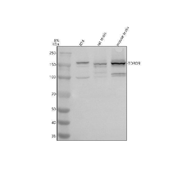 Western blot analysis of TDRD9 using anti-TDRD9 antibody (A11411)
