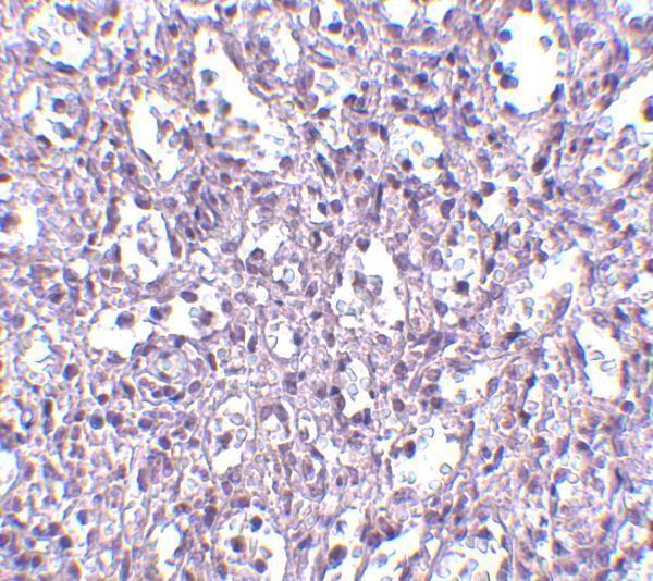 a11412 tbc1d10c primary antibodies ihc testing 2