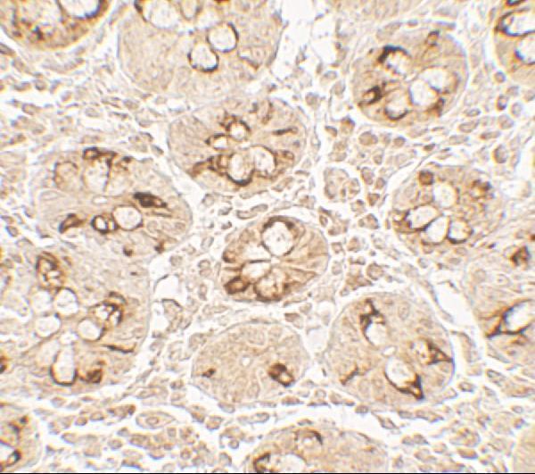Immunohistochemistry Validation of TMIGD2 in Human Small Intestine Tissue  
Immunohistochemical analysis of paraffin-embedded human small intestine tissue using anti-TMIGD2 antibody (A11415) at 5 μg /ml