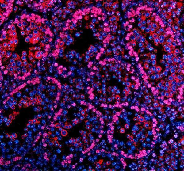 a11416 1 parp11 primary antibodies if testing 1