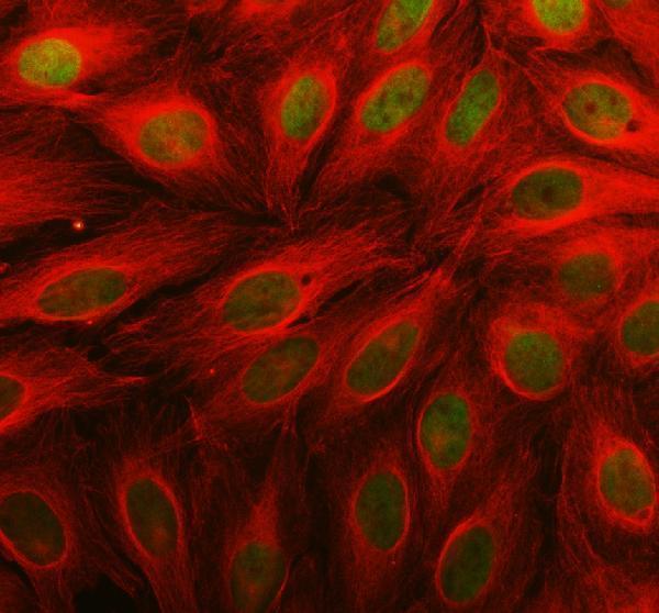 a11416 1 parp11 primary antibodies if testing 3