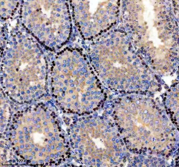 a11416 1 parp11 primary antibodies ihc testing 1