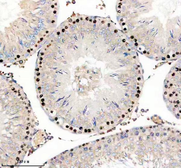 a11416 1 parp11 primary antibodies ihc testing 2