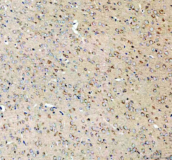 a11420 1 sez6l2 primary antibodies ihc testing 2