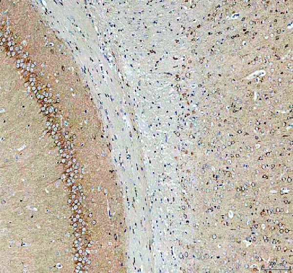 a11420 1 sez6l2 primary antibodies ihc testing 3