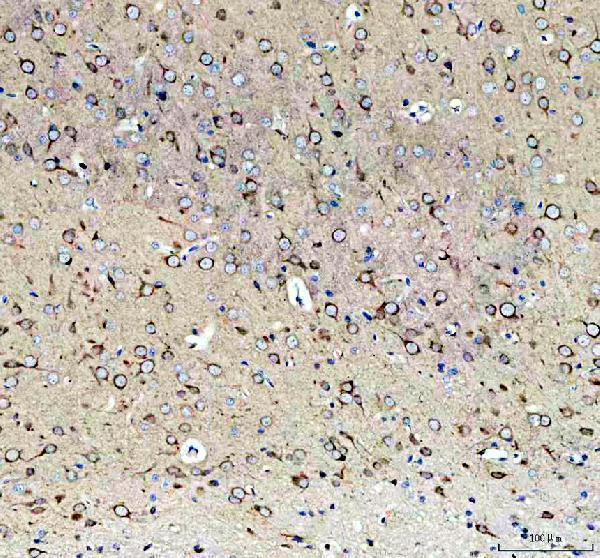 a11420 1 sez6l2 primary antibodies ihc testing 4