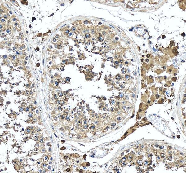 a11420 1 sez6l2 primary antibodies ihc testing 5