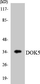 Western blot analysis of the lysates from HT-29 cells using DOK5 antibody