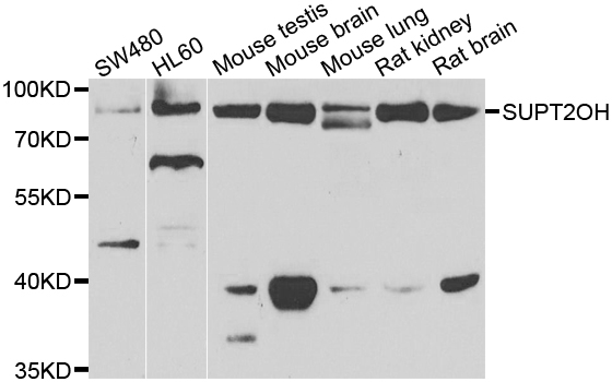 a11433 1 supt20h primary antiboties wb testing 1