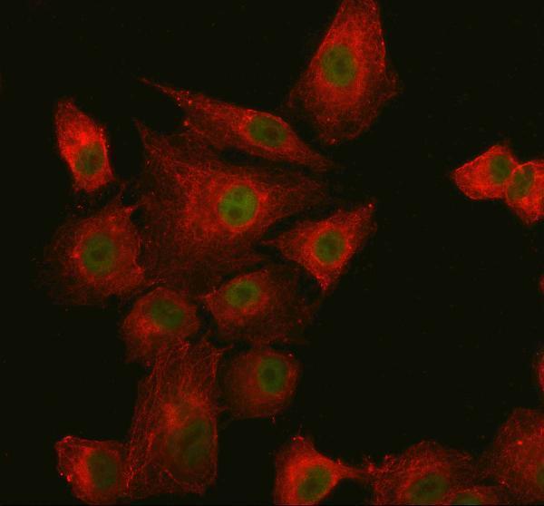  IF analysis of SUPT20H using anti-SUPT20H antibody (A11433-2) and anti-Beta Tubulin antibody (M01857-3)