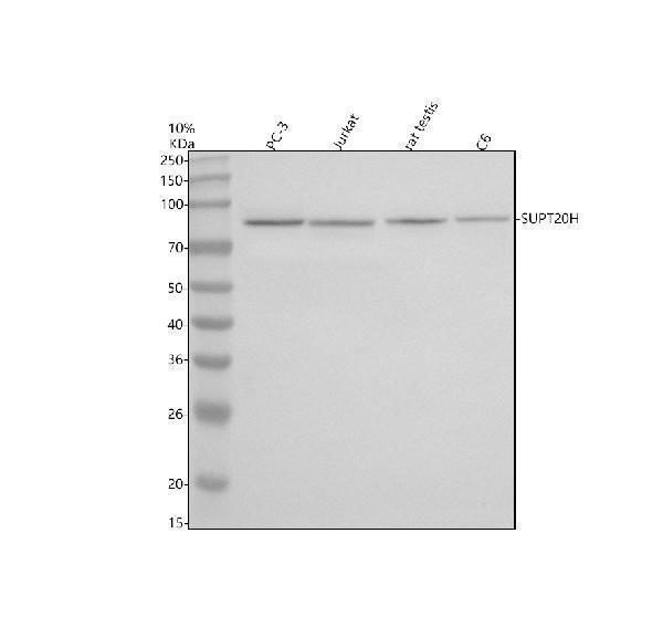 Western blot analysis of SUPT20H using anti-SUPT20H antibody (A11433-2)