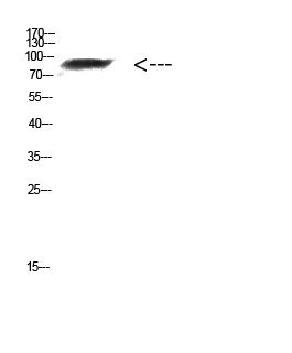 Western Blot analysis of mouse-kidney cells using Antibody diluted at 1000