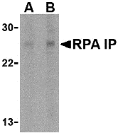 a11439 rpain primary antibodies wb testing 1