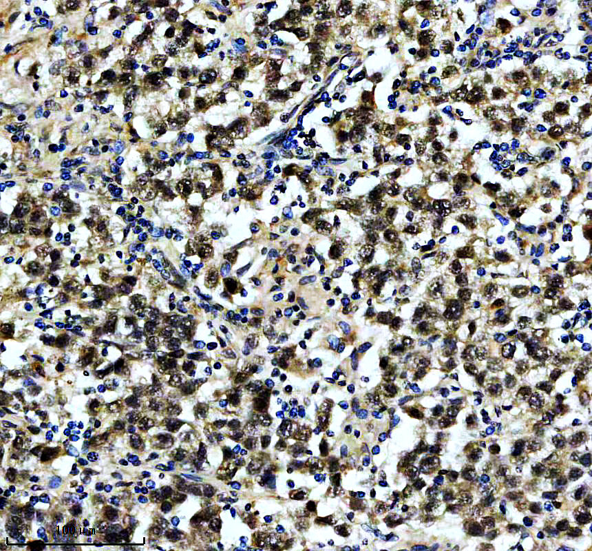 a11442 1 polr2j primary antibodies ihc testing 1