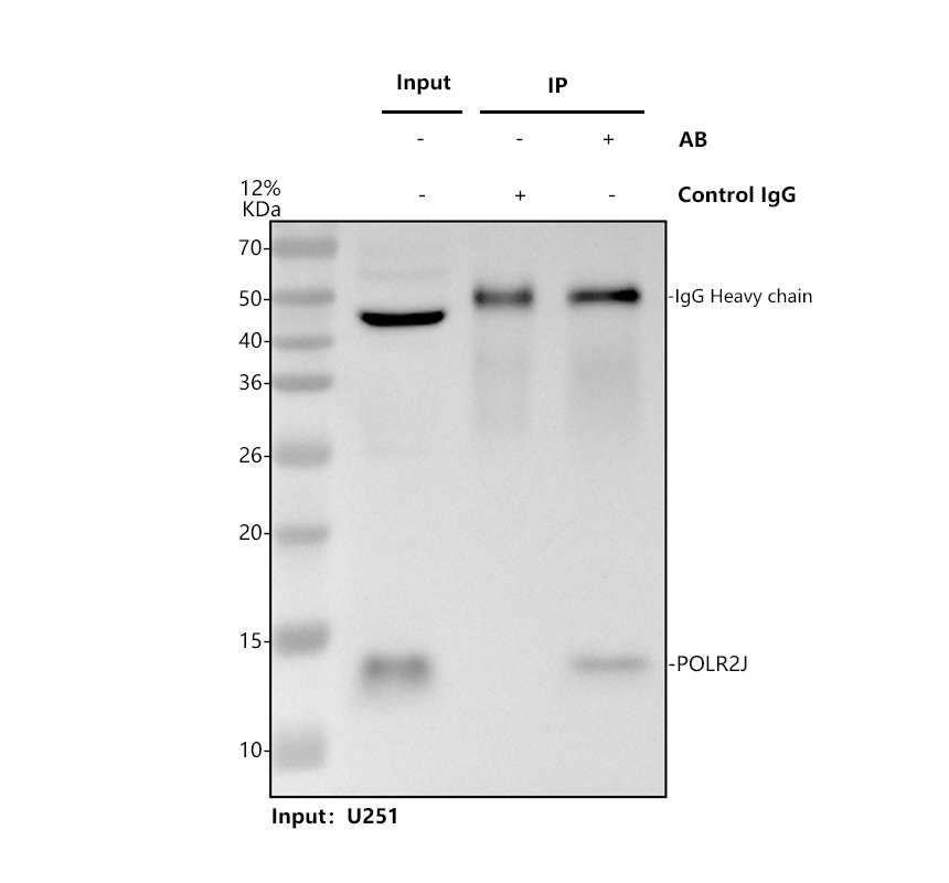 a11442 1 polr2j primary antibodies ip testing 1