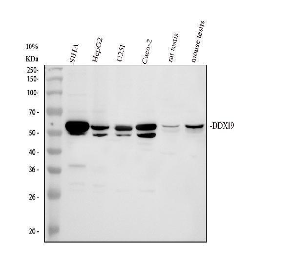 Western blot analysis of DDX19A/B using anti-DDX19A/B antibody (A11446-1)