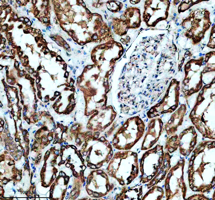 a11449 1 acsf2 primary antibodies ihc testing 1