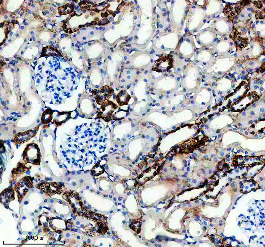 a11449 1 acsf2 primary antibodies ihc testing 2