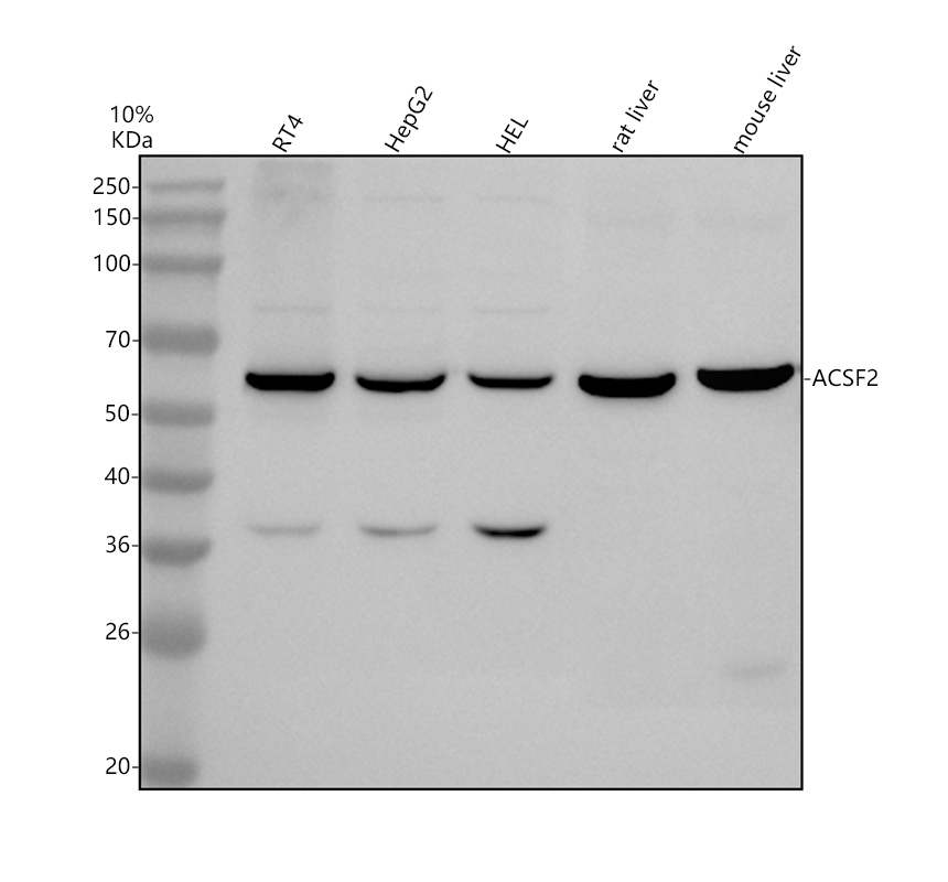 a11449 1 acsf2 primary antibodies wb testing 1