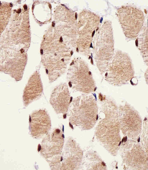 Immunohistochemical analysis of paraffin-embedded H. skeletal muscle section using SSNA1 Antibody (N-term). A11452-1 was diluted at 1:25 dilution. A undiluted biotinylated goat polyvalent antibody was used as the secondary, followed by DAB staining.