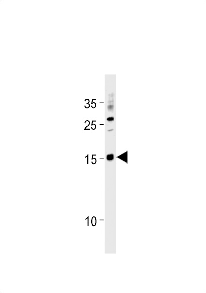 SSNA1 Antibody (N-term) western blot analysis in A2058 cell line lysates (35ug/lane).This demonstrates the SSNA1 antibody detected the SSNA1 protein (arrow).