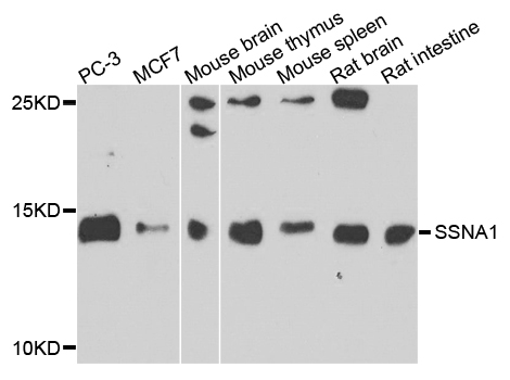 Western blot analysis of extracts of various cells, using SSNA1 antibody