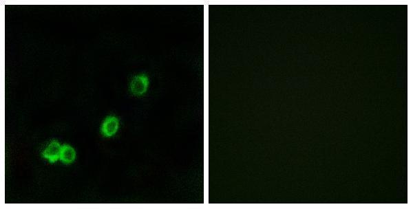 Immunofluorescence analysis of MCF7 cells, using ACOT1 Antibody