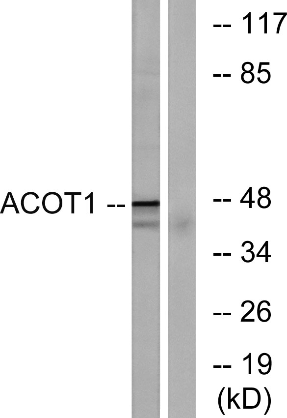Western blot analysis of lysates from Jurkat cells, using ACOT1 Antibody