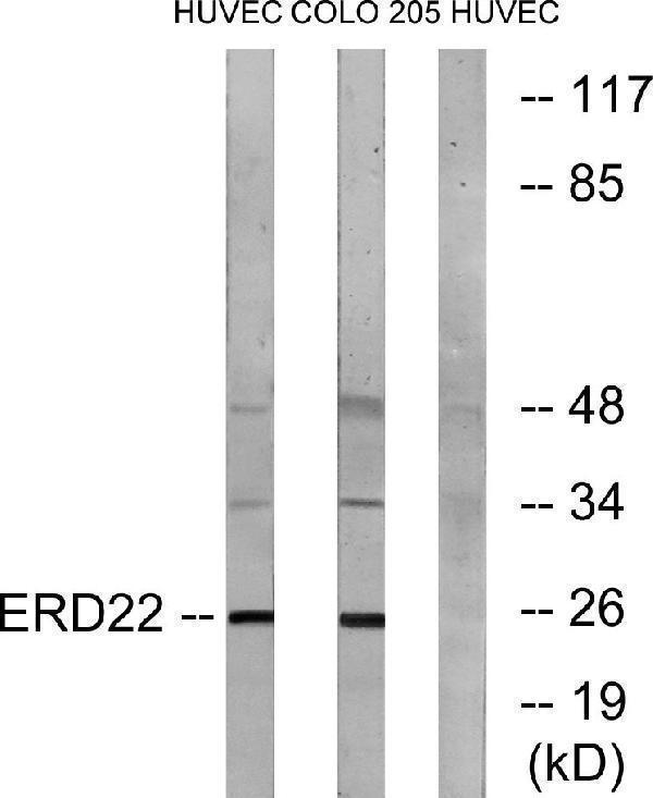 Western blot analysis of lysates from HUVEC and COLO cells, using ERD22 Antibody