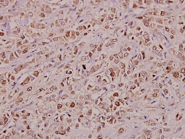 a11458 kdelr2 primary antiboties ihc testing 2