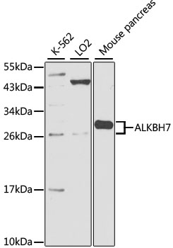 a11474 alkbh7 primary antiboties wb testing 1