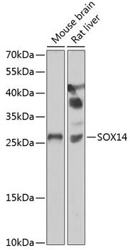 Western blot analysis of extracts of various cell lines, using SOX14 antibody at 1:1000 dilution