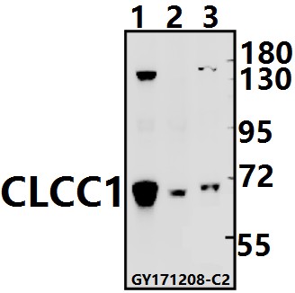 a11480 1 clcc1 primary antiboties wb testing 1