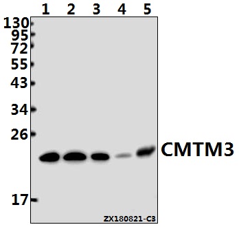 Western blot (WB) analysis of CMTM3 (E13) pAb at 1:500 dilution
Lane1:K562 whole cell lysate(40ug)
Lane2:A375 whole cell lysate(40ug)
Lane3:Hela whole cell lysate(40ug)
Lane4:The Embryo tissue lysate of Mouse(40ug)
Lane5:The Testis tissue lysate of Rat(40ug)