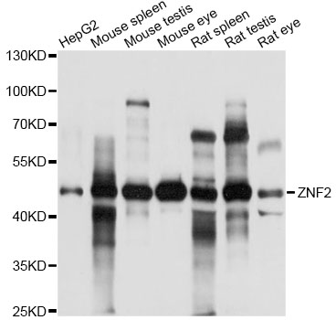 Western blot analysis of extracts of various cell lines, using ZNF2 antibody at 1:1000 dilution