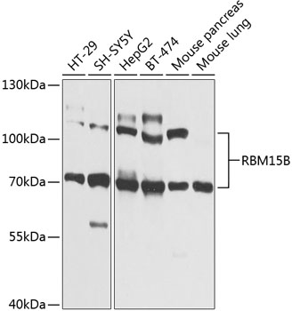a11484 rbm15b primary antiboties wb testing 1