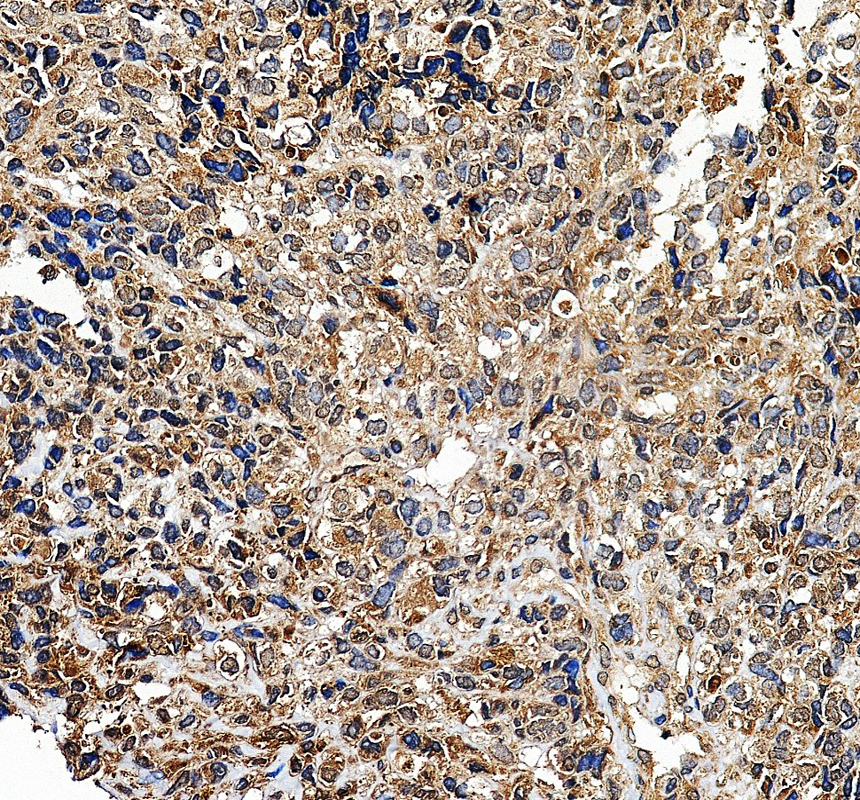 a11485 2 etv3 primary antibodies ihc testing 1