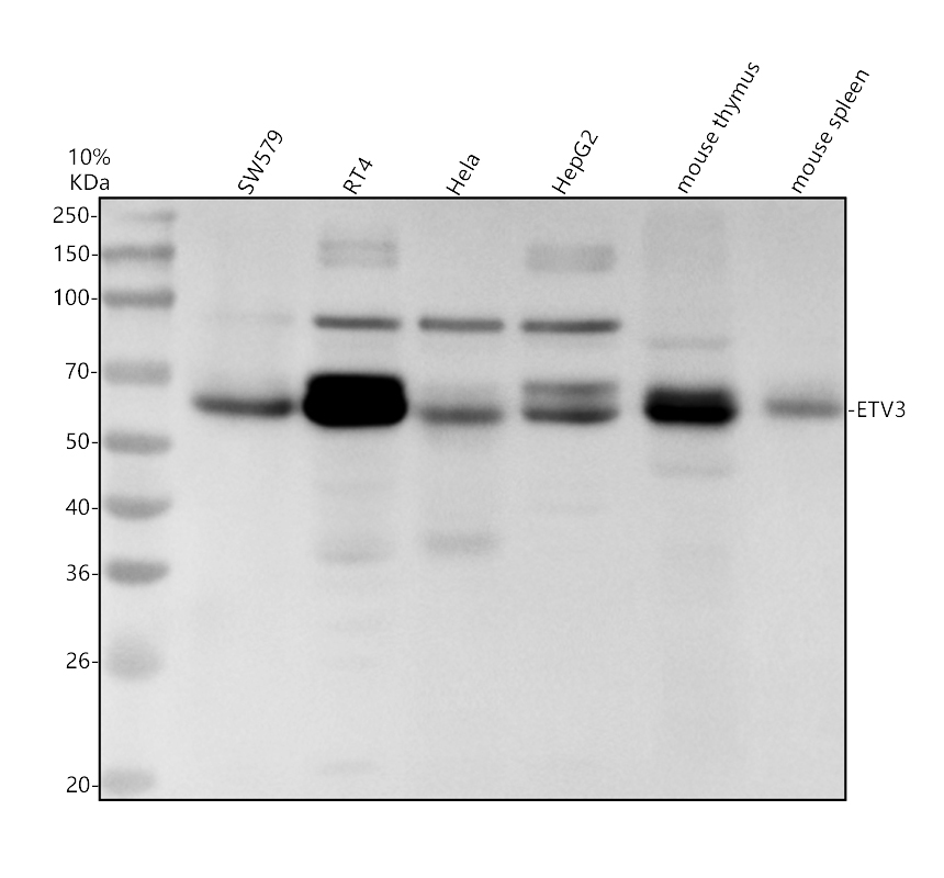 a11485 2 etv3 primary antibodies wb testing 1