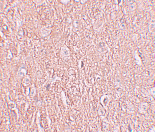 a11486 lrrtm2 primary antibodies ihc testing 2