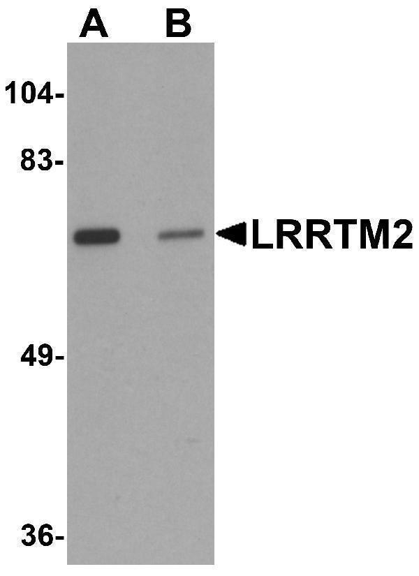 a11486 lrrtm2 primary antibodies wb testing 1