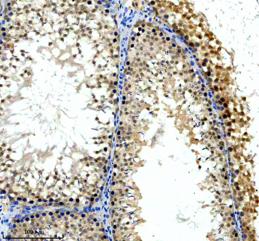 IHC analysis of SH3RF2 using anti-SH3RF2 antibody (A11489-1)