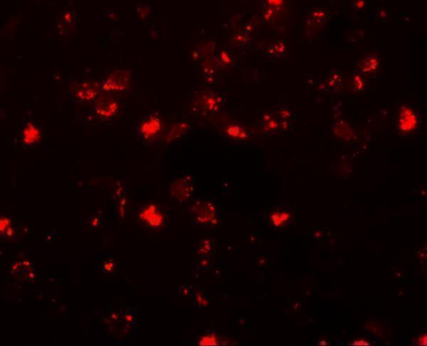 a11489 sh3rf2 primary antibodies if testing 3